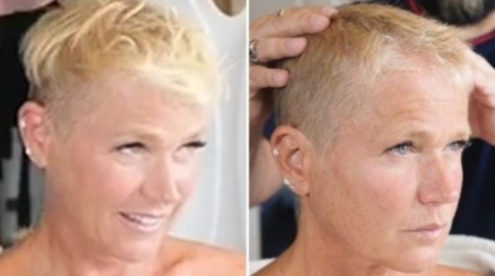 Xuxa Meneghel expôs batalha contra a alopecia — Foto: Reprodução