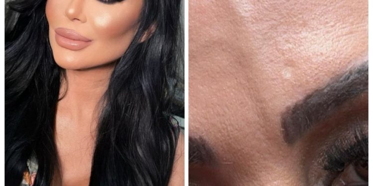 Ana Paula Oliveira removeu veia saltada da testa com laser e explicou motivo — Foto: Reprodução Instagram