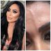 Ana Paula Oliveira removeu veia saltada da testa com laser e explicou motivo — Foto: Reprodução Instagram