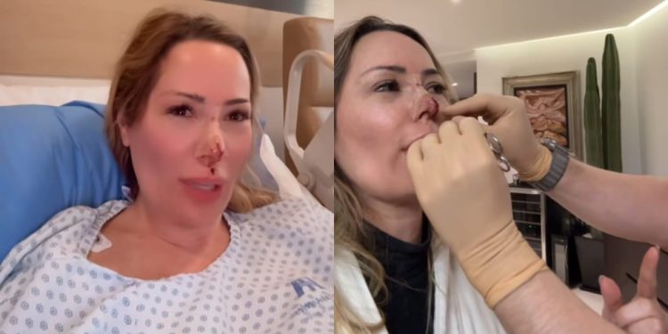 Influenciadora brasileira Ju Isen é atacada por cachorro no México e passa por cirurgia no nariz — Foto: Reprodução Instagram