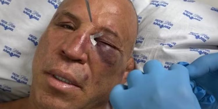 Wanderlei Silva chegou a ser hospitalizado após ficar desacordado — Foto: Reprodução