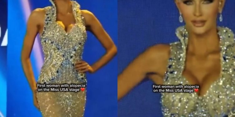 Mary Sickler faz história no Miss EUA ao desfilar sem cabelo — Foto: Reprodução Instagram @thequeenbeautynetwork