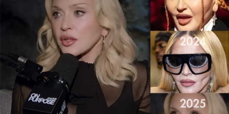Rosto de Madonna em 2025 sugere nova fase estética com foco na naturalidade — Foto: Divulgação