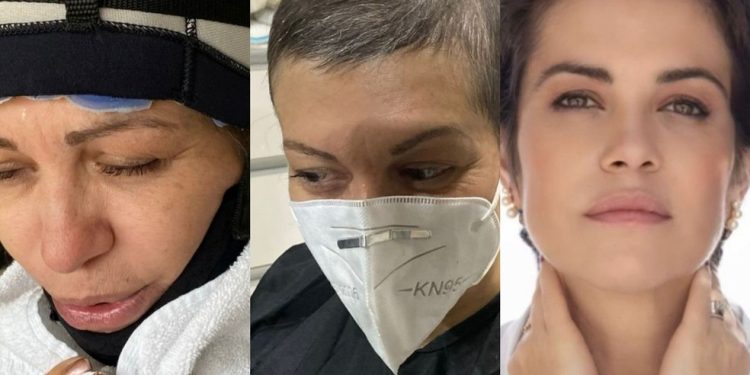 Médica perde cabelo durante quimioterapia e dá lição de autoestima no Outubro Rosa — Foto: Arquivo pessoal / CO Assessoria