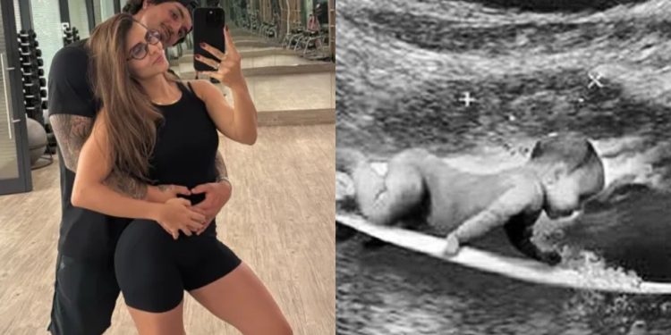 Grávida do primeiro filho com Gabriel Medina, Isabella Arantes ganhou os holofotes — Foto: Reprodução Instagram