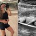 Grávida do primeiro filho com Gabriel Medina, Isabella Arantes ganhou os holofotes — Foto: Reprodução Instagram