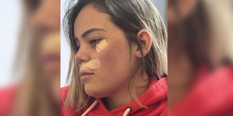 'Minha única reação era gritar por socorro', diz brasileira vítima de tentativa de estupro em metrô de Paris — Foto: Reprodução
