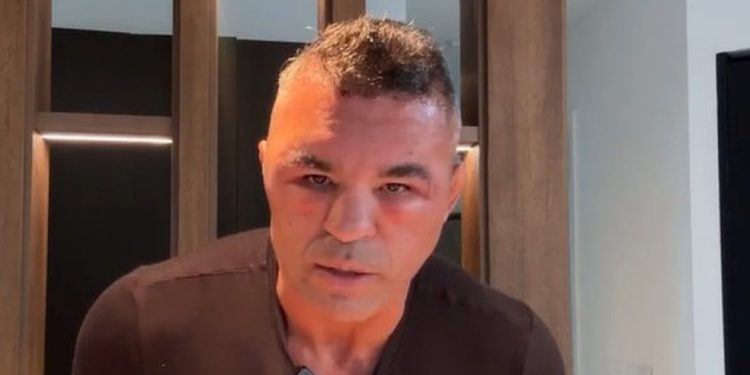 Vitor Belfort faz live com Joana Prado e mostra rosto inchado após transplante capilar — Foto: Reprodução