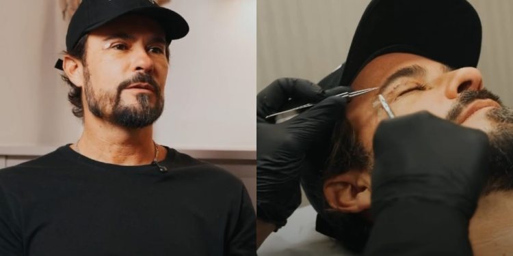 Blefaroplastia de Paulinho Vilhena: especialista explica efeitos e benefícios do procedimento — Foto: Reprodução Instagram