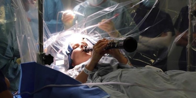 Portadora da doença de Parkinson, Denise Bacon, de 65 anos, tocou clarinete enquanto era submetida a uma cirurgia no cérebro — Foto: Reprodução