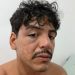 O músico Ivo Silva de Souza após sofrer agressão em janeiro — Foto: Arquivo pessoal