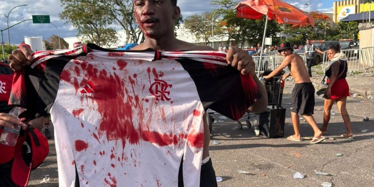 Torcedor com camisa ensanguentada — Foto: Alexandre Cassiano