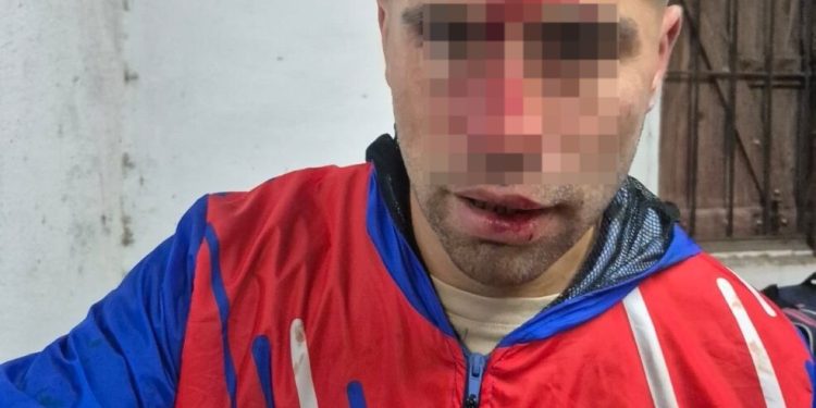Jogador fica com chave de carro cravada na testa após briga — Foto: Reprodução
