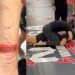 Lutadora mostra marcas de mordida no antebraço após luta e critica adversária: 'Adoro dar lição em valentões'; vídeo