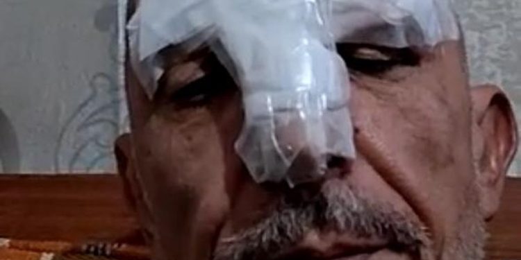 Cravinhos levou doze pontos na cabeça e três no rosto após acidente — Foto: Arquivo pessoal