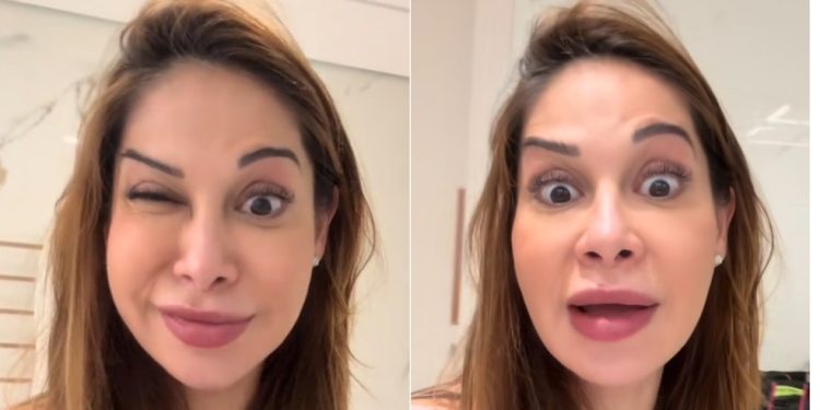 Maíra Cardi fica com a sobrancelha torta após uso de botox no rosto — Foto: Reprodução/Instagram