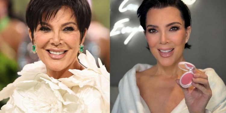 Kris Jenner antes e depois do lifting facial profundo, exibindo o brilho natural e o efeito rejuvenescedor — Foto: Getty Images/@krisjenner