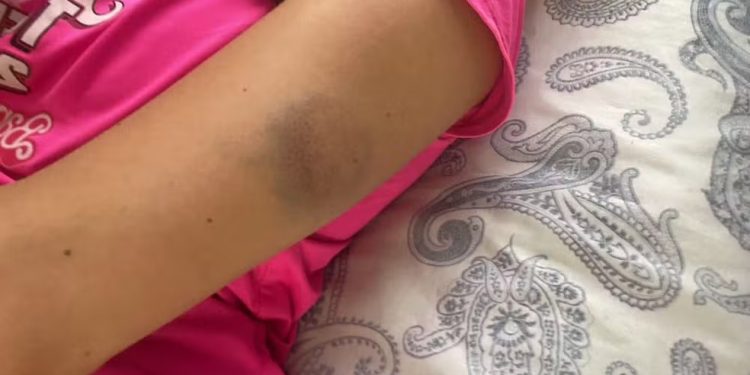 Namorada de Thiago Schutz denuncia agressão — Foto: Reprodução