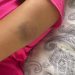 Namorada de Thiago Schutz denuncia agressão — Foto: Reprodução