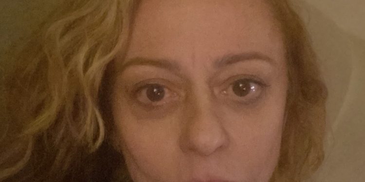 Fãs saem em defesa de Guta Stresser em foto sem filtro: 'É só o rosto de uma mulher cheia de histórias'