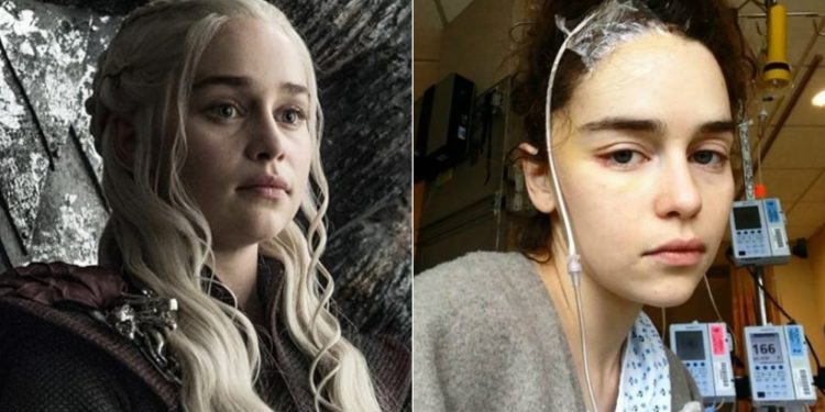 Game of Thrones: atriz da série diz que 'deveria ter morrido’ após passar por cirurgias para tratar de dois aneurismas cerebrais