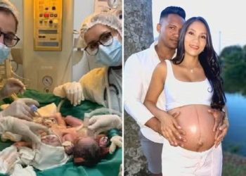 Bebês siameses de Goiás morrem após infecção intestinal grave provocar parada cardíaca em um dos irmãos; entenda