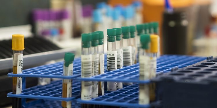 Câncer de pulmão: pesquisa brasileira identifica nova mutação relacionada à doença
