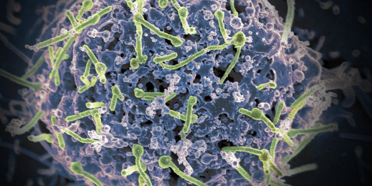 Ebola se esconde no sistema nervoso central, descobre estudo