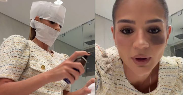 Thássia Naves diverte seguidores com técnica inusitada de make: 'Mirei nas sardas e acertei no soco'