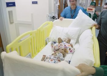Um a cada 10 milhões: entenda cirurgia que separou gêmeas siamesas unidas pela cabeça e envolveu médicos do Brasil e de outros três países — Foto: Reprodução