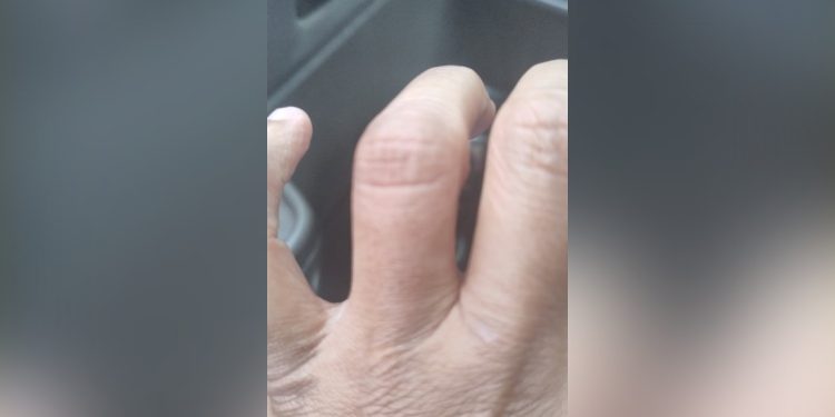 Assaltante ataca motorista de táxi a dentada para levar aliança, próximo de batalhão da PM; 'Era latão'