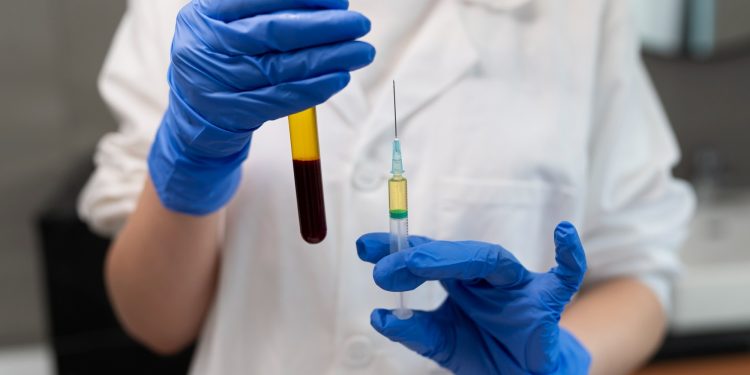 CFM libera uso de plasma rico em plaquetas para tratamento de condições específicas; entenda e saiba quais