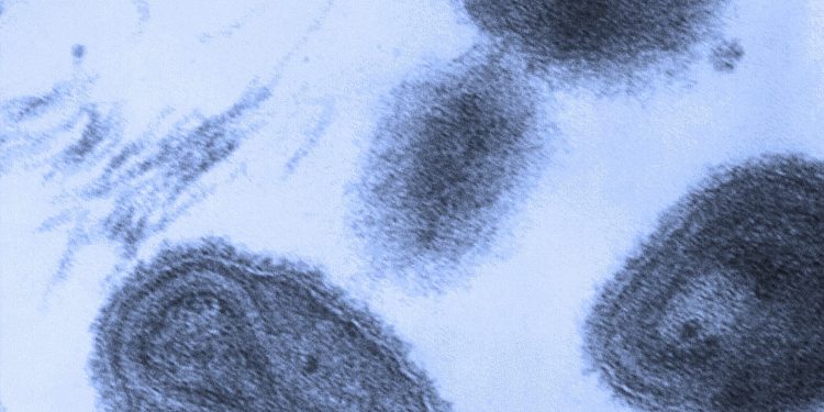 Cientistas acham DNA de vírus da varíola europeu em múmias chilenas de 500 anos