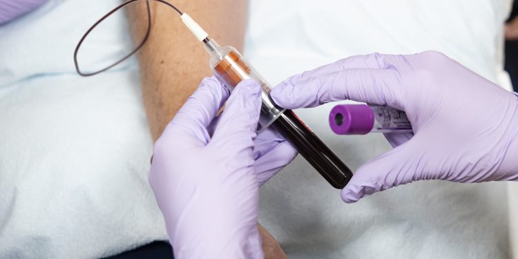 Colesterol: o que você precisa saber sobre o novo e poderoso comprimido aprovado nos EUA