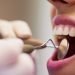 Uma cárie nem sempre precisa de obturação, um canal nem sempre é necessário: as novas técnicas nas salas dos dentistas