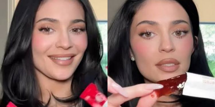 A 'geleca' de Kylie Jenner viralizou. Mas ela é mesmo inofensiva?