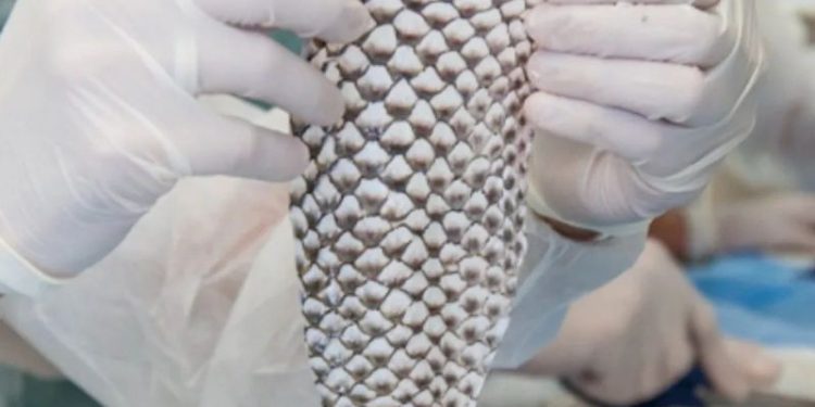 Brasil terá primeira fábrica do mundo de pele de tilápia para tratar queimaduras; entenda tecnologia