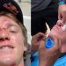 Do hospital ao pódio: Lucas Fink sofre acidente antes da final, compete com nariz fraturado e é vice no Gigantes de Nazaré