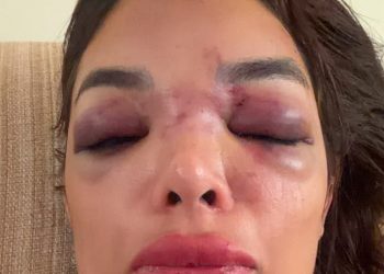 Empresário da Faria Lima é preso em flagrante por agredir mulher: ‘Deixou meu rosto deformado’