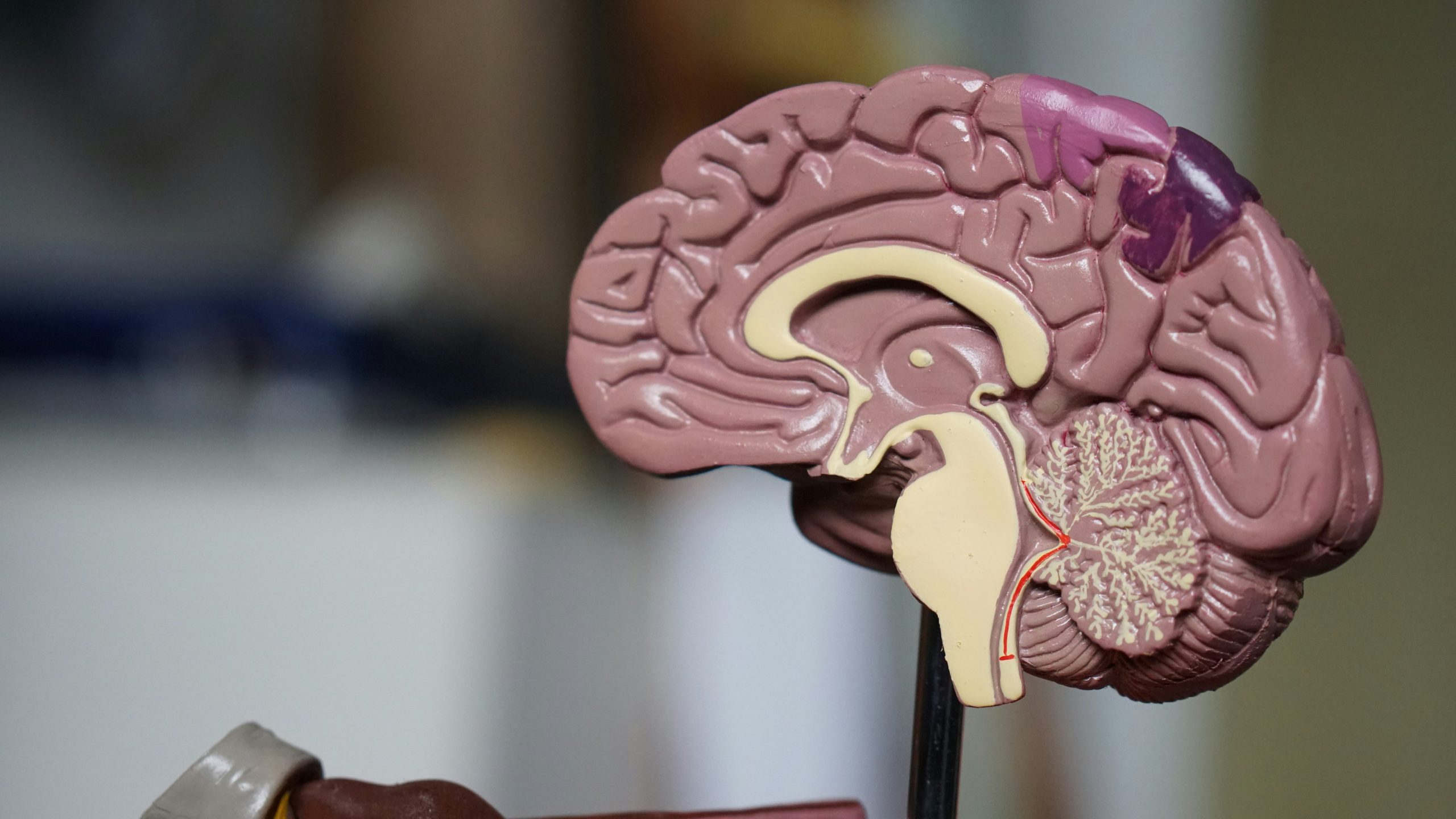 Estudo encontra doença cerebral degenerativa em 215 ex-jogadores da NFL que doaram cérebros para pesquisa