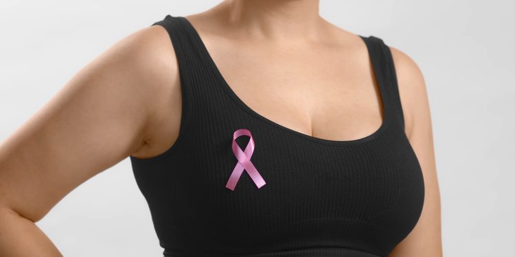 Inteligência Artificial contra a quimioterapia desnecessária com mulheres com câncer de mama