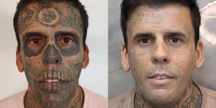 Leandro Souza: quem é o homem 'mais tatuado do Brasil', que descobriu tumor na bexiga antes de sessão para remover tatuagens