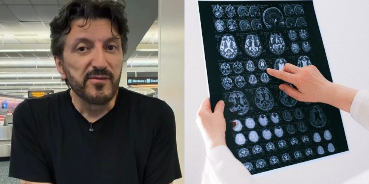 Lito Sousa: o que é e como funciona o Home Care para a Doença de Creutzfeldt-Jakob?