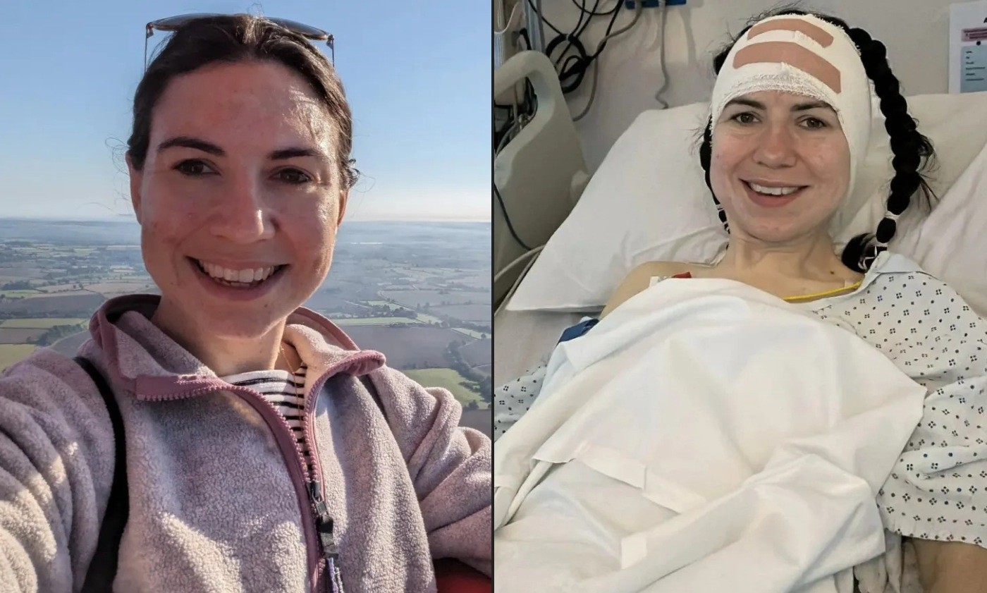 Mulher de 33 anos descobre câncer de pulmão em estágio 4 após anos de tosse e rouquidão na Inglaterra
