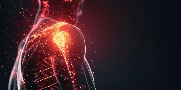 Novos procedimentos tratam a dor no ombro sem cirurgia