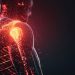 Novos procedimentos tratam a dor no ombro sem cirurgia