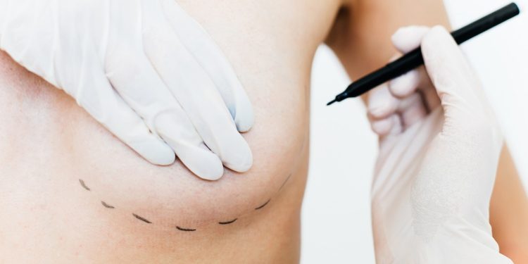 O salto nas cirurgias plásticas de mama pelo SUS