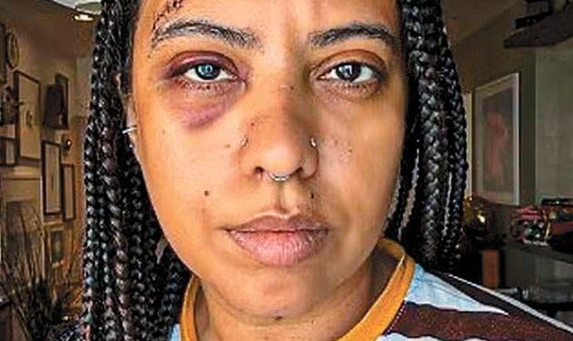 Vivi para contar: 'Uma sequência de violência, só porque eu era a pessoa mais fraca', relata influenciadora agredida por homem na Lapa