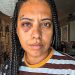 Vivi para contar: 'Uma sequência de violência, só porque eu era a pessoa mais fraca', relata influenciadora agredida por homem na Lapa