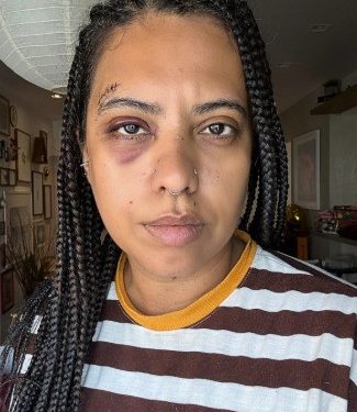 ‘Quando o homem voltou, a partir daí, eu só lembro de violência’, diz influenciadora após ser agredida em roda de samba na Lapa